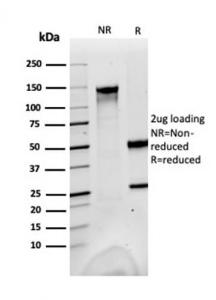 Anti-FABP1 antibody