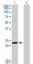 Anti-RCVRN Mouse Monoclonal Antibody [clone: 1B7]