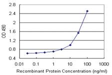 Anti-CSTB Polyclonal Antibody Pair