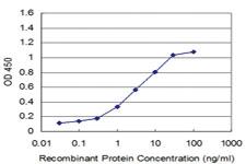 Anti-RCVRN Mouse Monoclonal Antibody [clone: 1B7]