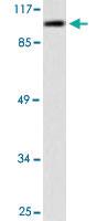 Anti-CDH1 Rabbit Polyclonal Antibody