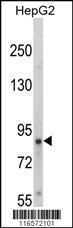 Anti-NTRK1 Rabbit Polyclonal Antibody (HRP (Horseradish Peroxidase))