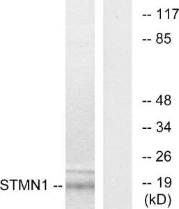 Western blot analysis of lysates from COS7 cells using Anti-Stathmin 1 Antibody. The right hand lane represents a negative control, where the antibody is blocked by the immunising peptide