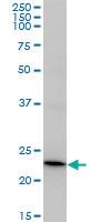 Anti-RCVRN Mouse Monoclonal Antibody [clone: 3F6]