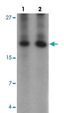 Anti-ANG Rabbit Polyclonal Antibody