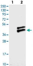 Anti-RWDD2B Rabbit Polyclonal Antibody