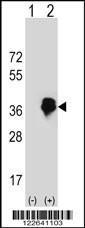 Anti-MLX Rabbit Polyclonal Antibody