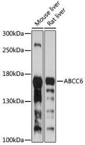 Anti-MRP6/ARA antibody