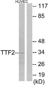 Western blot analysis of lysates from HUVEC cells using Anti-TTF2 Antibody. The right hand lane represents a negative control, where the antibody is blocked by the immunising peptide.