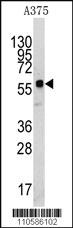 Anti-KREMEN1 Rabbit Polyclonal Antibody