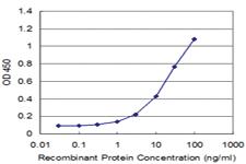 Anti-RCVRN Mouse Monoclonal Antibody [clone: 3F6]