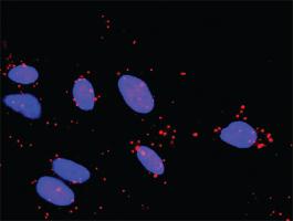 Anti-TAOK2 Mouse Monoclonal Antibody [clone: 2F4]