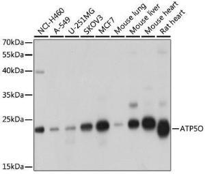 Anti-ATP5O Antibody (A10296)