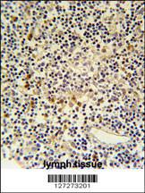 Anti-CORO6 Rabbit Polyclonal Antibody (PE (Phycoerythrin))