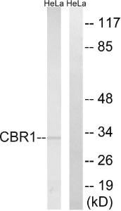 Western blot analysis of lysates from HeLa cells using Anti-CBR1 Antibody. The right hand lane represents a negative control, where the antibody is blocked by the immunising peptide