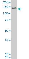 Anti-MLLT10 Mouse Monoclonal Antibody [clone: 6H7]