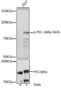 Western blot analysis of extracts of 293T cells, using Anti-PKC delta (phospho Ser645) Antibody (A308494) at 1:1000 dilution or PKC delta Antibody (A0471). 293T cells were treated by PMA/TPA (200 nM) at 37°C for 30  minutes after serum-starvation overnight.