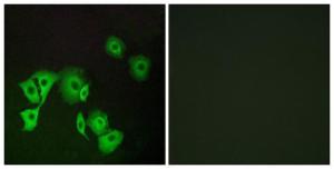 Anti-TTF2 antibody