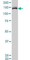 Anti-MLLT10 Mouse Monoclonal Antibody [clone: 6H7]