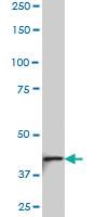 Anti-NDST3 Mouse Monoclonal Antibody [clone: 5B9]