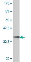 Anti-VPS50 Mouse Polyclonal Antibody