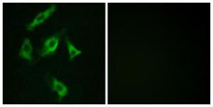 Immunofluorescence analysis of COS7 cells using Anti-Stathmin 1 Antibody. The right hand panel represents a negative control, where the antibody was pre-incubated with the immunising peptide