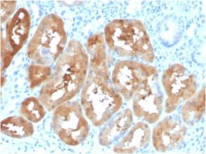 Immunohistochemical analysis of formalin-fixed, paraffin-embedded human kidney using Anti-FABP1 Antibody [FABP1/3484]