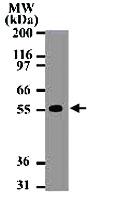 Anti-TNFRSF10A Mouse Monoclonal Antibody [clone: 32A1380]