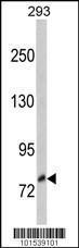 Anti-NTRK3 Rabbit Polyclonal Antibody (APC (Allophycocyanin))