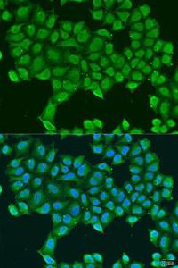 Immunofluorescence analysis of U2OS cells using Anti-ATP5O Antibody (A10296) at a dilution of 1:100. DAPI was used to stain the cell nuclei (blue)