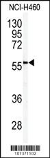 Anti-PARK2 Rabbit Polyclonal Antibody