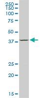 Anti-ACAA2 Mouse Monoclonal Antibody [clone: 2F7]