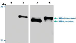 Anti-NFKBIA Mouse Monoclonal Antibody [clone: 39A1413]