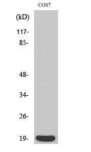 Western blot analysis of various cells using Anti-Stathmin 1 Antibody