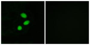 Immunofluorescence analysis of MCF7 cells using Anti-TSH2 Antibody. The right hand panel represents a negative control, where the Antibody was pre-incubated with the immunising peptide