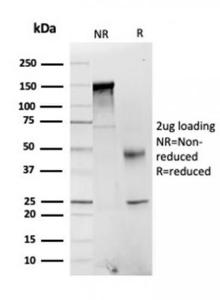 SDS-PAGE analysis of Anti-FABP1 Antibody [FABP1/3484] under non-reduced and reduced conditions; showing intact IgG and intact heavy and light chains, respectively. SDS-PAGE analysis confirms the integrity and purity of the antibody.