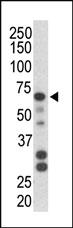 Anti-PARK2 Rabbit Polyclonal Antibody