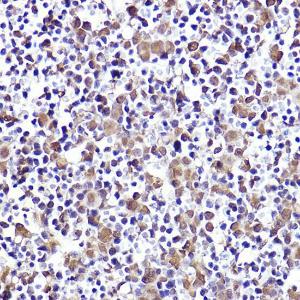 Immunohistochemistry analysis of paraffin-embedded mouse fetal liver using Anti-CMIP Antibody (A308496) at a dilution of 1:50 (40X lens). Perform high pressure antigen retrieval with 10 mM citrate buffer pH 6.0 before commencing with IHC staining protocol