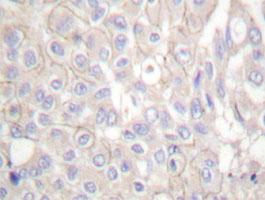 Anti-CDH1 Rabbit Polyclonal Antibody