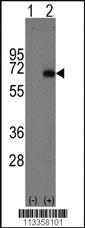 Anti-AFP Rabbit Polyclonal Antibody