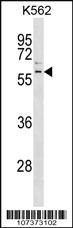 Anti-PARK2 Rabbit Polyclonal Antibody