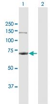 Anti-RPA1 Rabbit Polyclonal Antibody