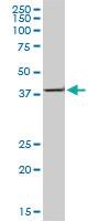 Anti-ACAA2 Mouse Monoclonal Antibody [clone: 2F7]