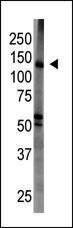 Anti-MAGI1 Rabbit Polyclonal Antibody (AP (Alkaline Phosphatase))