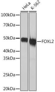 Western blot analysis of extracts of various cell lines, using Anti-FOXL2 Antibody [ARC2055] (A307530) at 1:1,000 dilution The secondary antibody was Goat Anti-Rabbit IgG H&L Antibody (HRP) at 1:10,000 dilution Lysates/proteins were present at 25 µg per lane