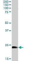 Anti-HSPB8 Goat Polyclonal Antibody