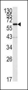 Anti-NMT1 Rabbit Polyclonal Antibody (AP (Alkaline Phosphatase))