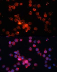 Immunofluorescence analysis of Jurkat cells using Anti-CD66b Antibody (A10300) at a dilution of 1:100. DAPI was used to stain the cell nuclei (blue)