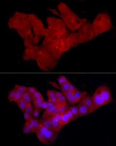 Immunofluorescence analysis of HepG2 using Anti-Claudin 1 Antibody [ARC54475] (A305830) at a dilution of 1:100(40x lens) DAPI was used to stain the cell nuclei (blue)