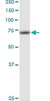 Anti-RPA1 Rabbit Polyclonal Antibody